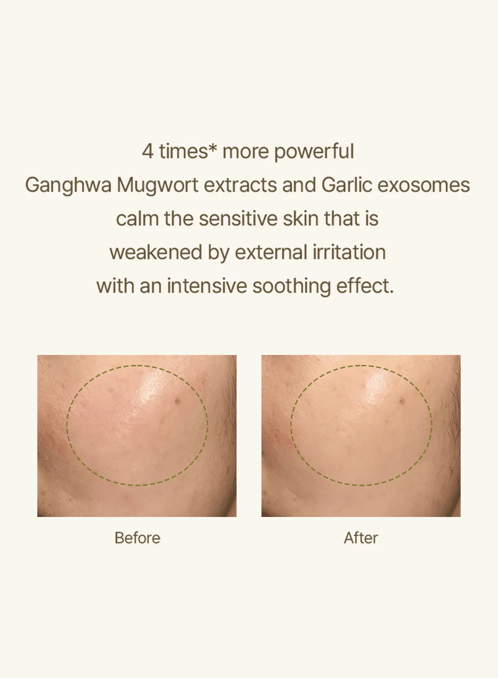 Mugwort Serum (30ml) - Image 9